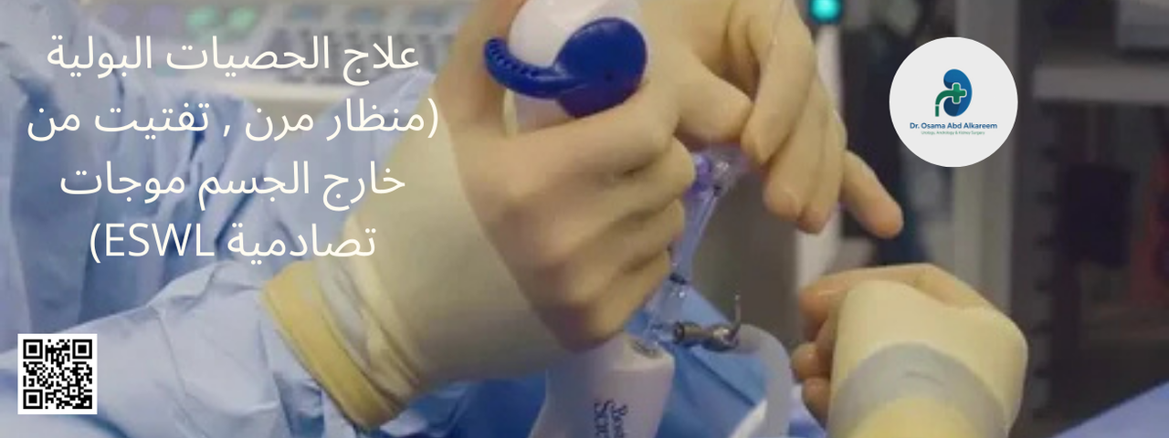 علاج الحصيات البولية (المنظار المرن – التفتيت بالموجات التصادمية ESWL) ما هي الحصيات البولية؟ الحصيات البولية هي تجمعات صلبة من الأملاح والمعادن تتشكل داخل الجهاز البولي، وقد تظهر في الكلى أو الحالب أو المثانة. يمكن أن تسبب هذه الحصيات ألماً شديداً في الخاصرة أو أسفل البطن، وقد تؤدي إلى صعوبة في التبول أو ظهور دم في البول، وفي بعض الحالات قد تسبب التهابات بولية متكررة.